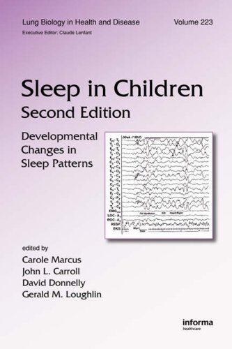 Sleep in Children.