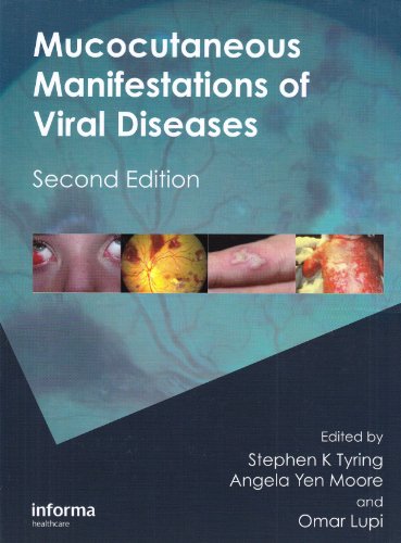 Mucocutaneous Manifestations of Viral Diseases