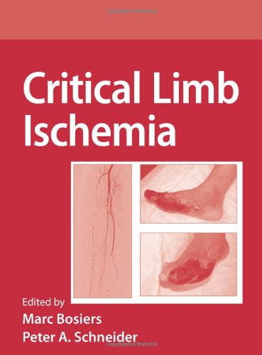 Critical Limb Ischemia