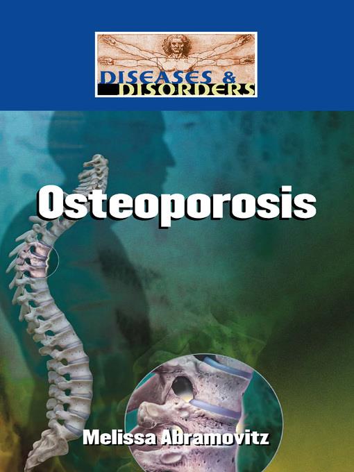 Osteoporosis