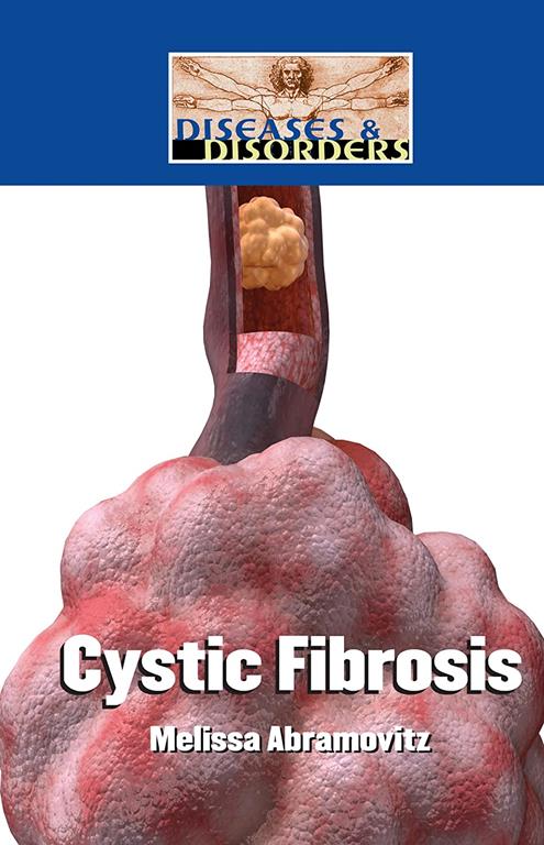 Cystic Fibrosis (Diseases and Disorders)