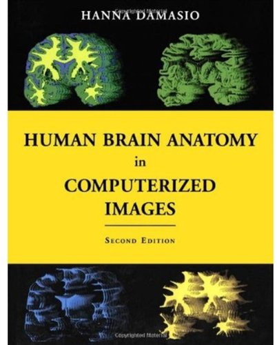 Human Brain Anatomy in Computerized Images