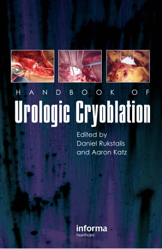 Handbook of urologic cryoablation