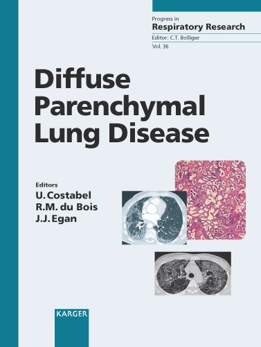 Diffuse parenchymal lung disease