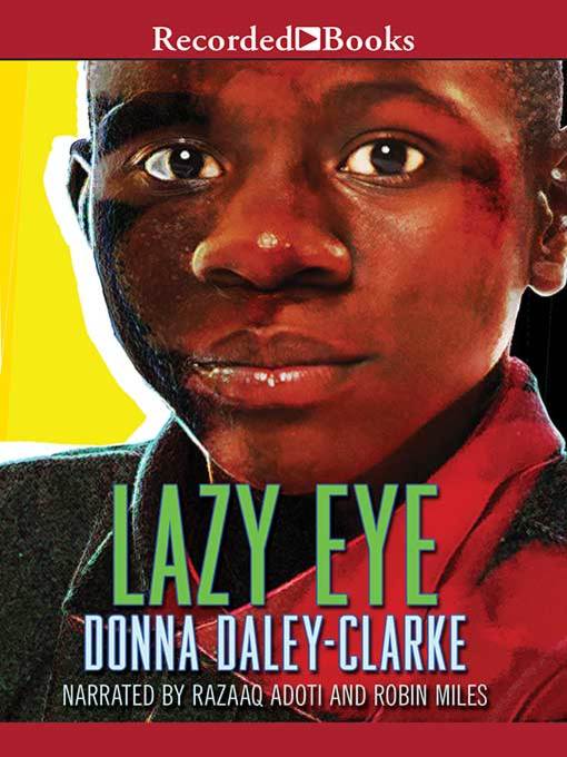 Lazy Eye