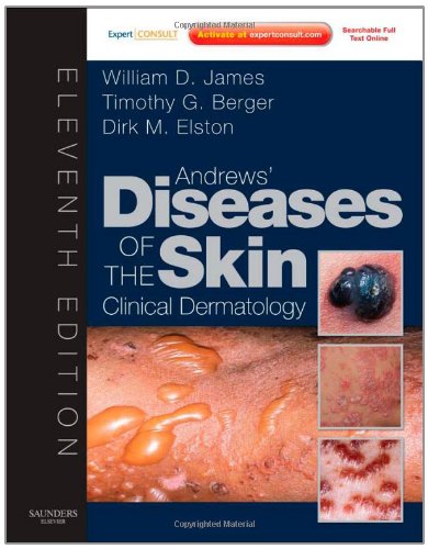 Andrews' Diseases of the Skin