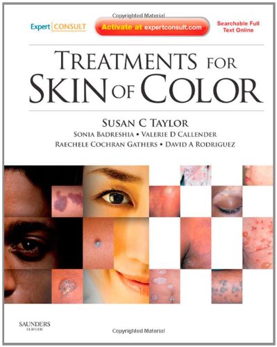 Treatments For Skin Of Color