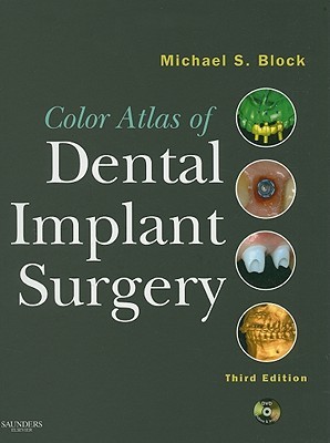 Color Atlas of Dental Implant Surgery