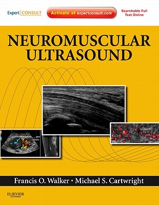 Neuromuscular Ultrasound