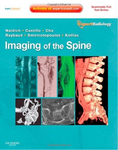 Imaging of the Spine