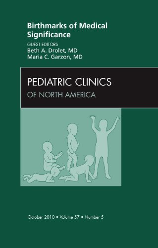 Birthmarks of Medical Significance, an Issue of Pediatric Clinics, 57