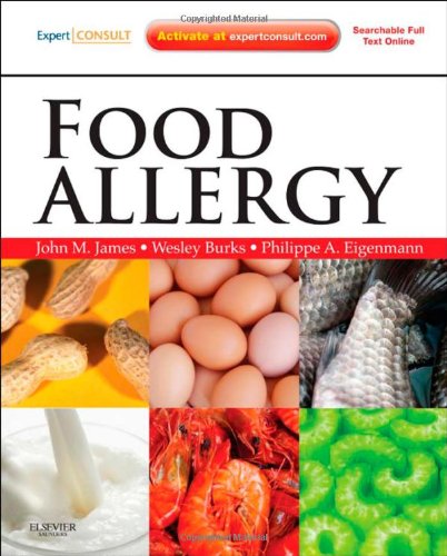 Food Allergy