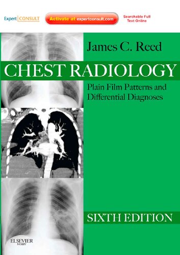 Chest Radiology