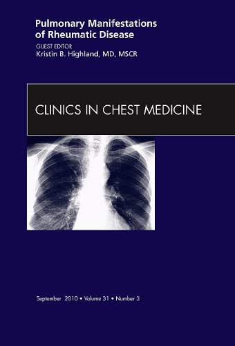 Pulmonary Manifestations of Rheumatic Disease, an Issue of Clinics in Chest Medicine, 31