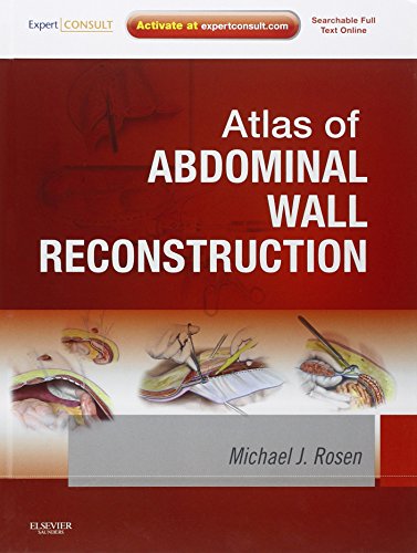 Atlas of Abdominal Wall Reconstruction