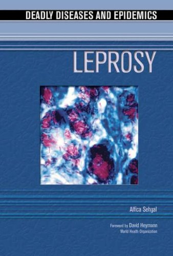 Leprosy