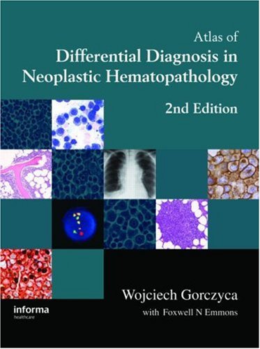 Atlas of differential diagnosis in neoplastic hematopathology