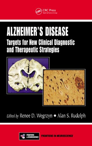 Alzheimer's Disease