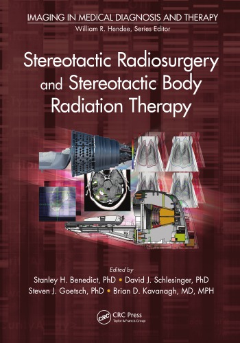 Stereotactic radiosurgery and stereotactic body radiation therapy