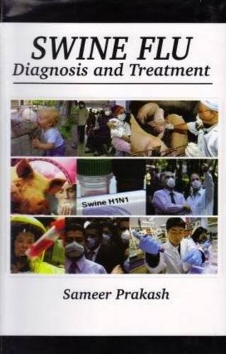 Swine flu : diagnosis & treatment