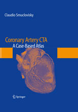 Coronary Artery CTA