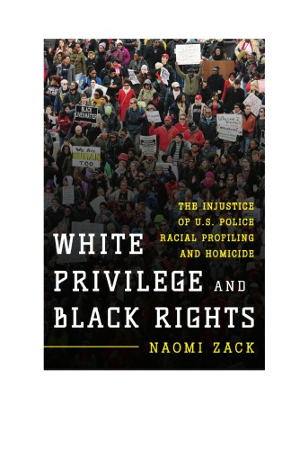 White Privilege and Black Rights