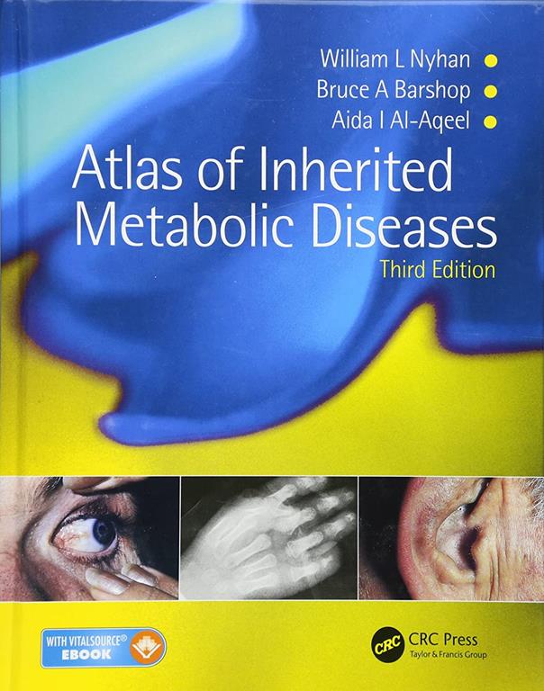 Atlas of Inherited Metabolic Diseases