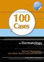 100 Cases in Dermatology