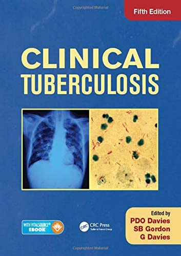 Clinical Tuberculosis