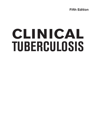 Clinical tuberculosis