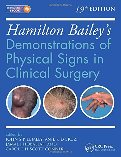 Hamilton Bailey's Physical Signs