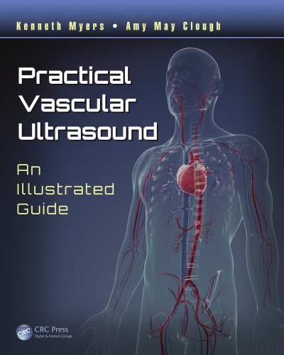 Practical vascular ultrasound : an illustrated guide