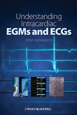 Understanding intracardiac EGMs and ECG's