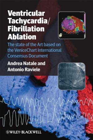 Ventricular tachycardia/fibrillation ablation : the state of the art based on the VeniceChart international consensus document