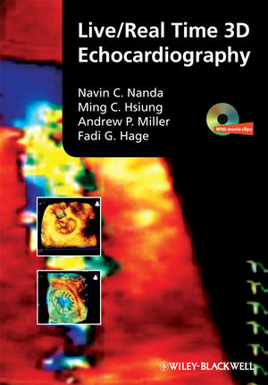 Live/real time 3D echocardiography