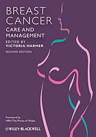 Breast Cancer Nursing Care and Management