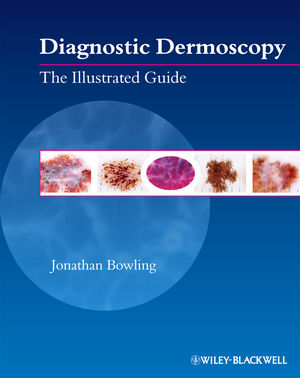 Diagnostic dermoscopy : the Illustrated guide