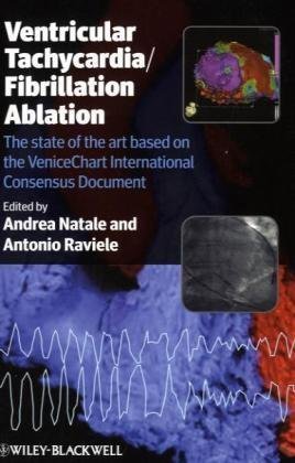 Ventricular Tachycardia / Fibrillation Ablation