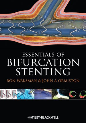 Essentials of Bifurcation Stenting