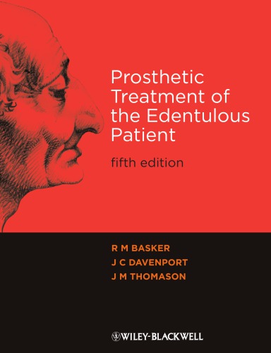 Prosthetic Treatment of the Edentulous Patient