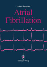 Atrial Fibrillation.