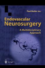 Endovascular Neurosurgery : a Multidisciplinary Approach