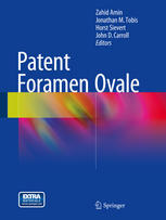 Patent Foramen Ovale