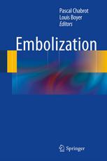 Embolization