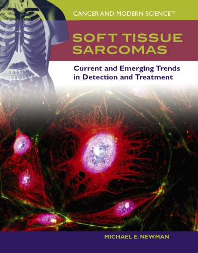 Soft Tissue Sarcomas