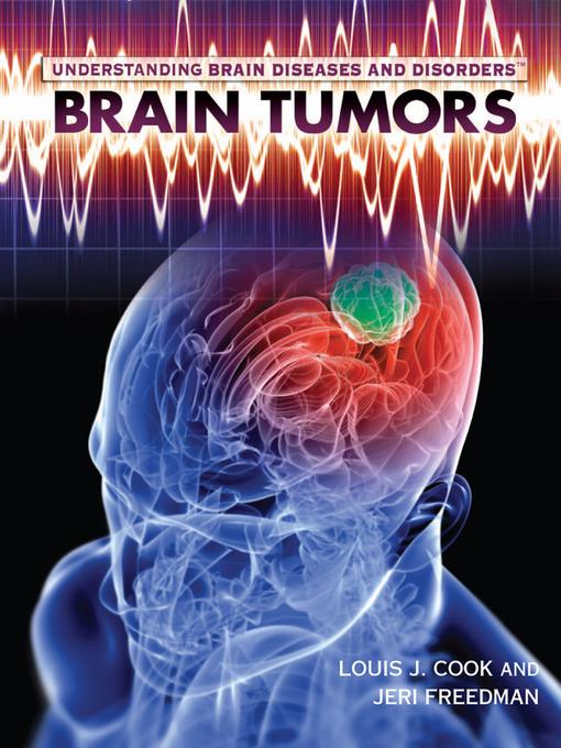 Brain Tumors