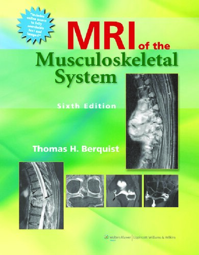 MRI of the Musculoskeletal System