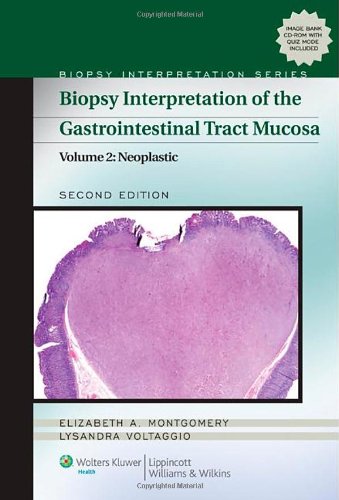 Biopsy Interpretation of the Gastrointestinal Tract Mucosa: Neoplastic (Biopsy Interpretation Series)