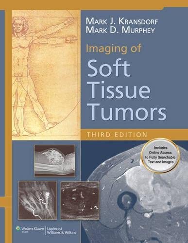 Imaging of Soft Tissue Tumors