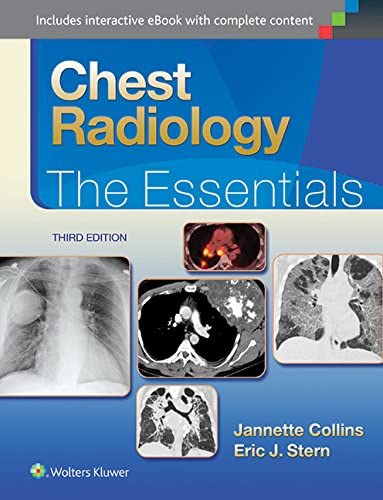 Chest Radiology